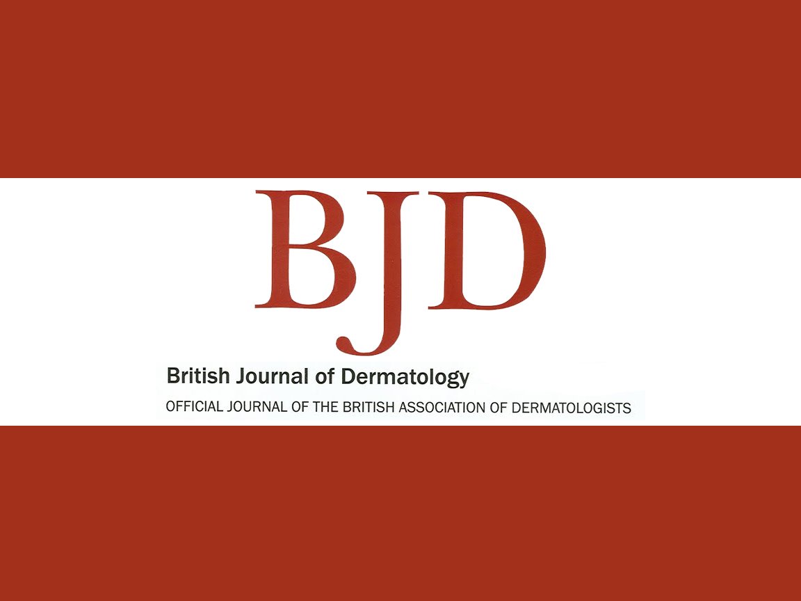 bjd